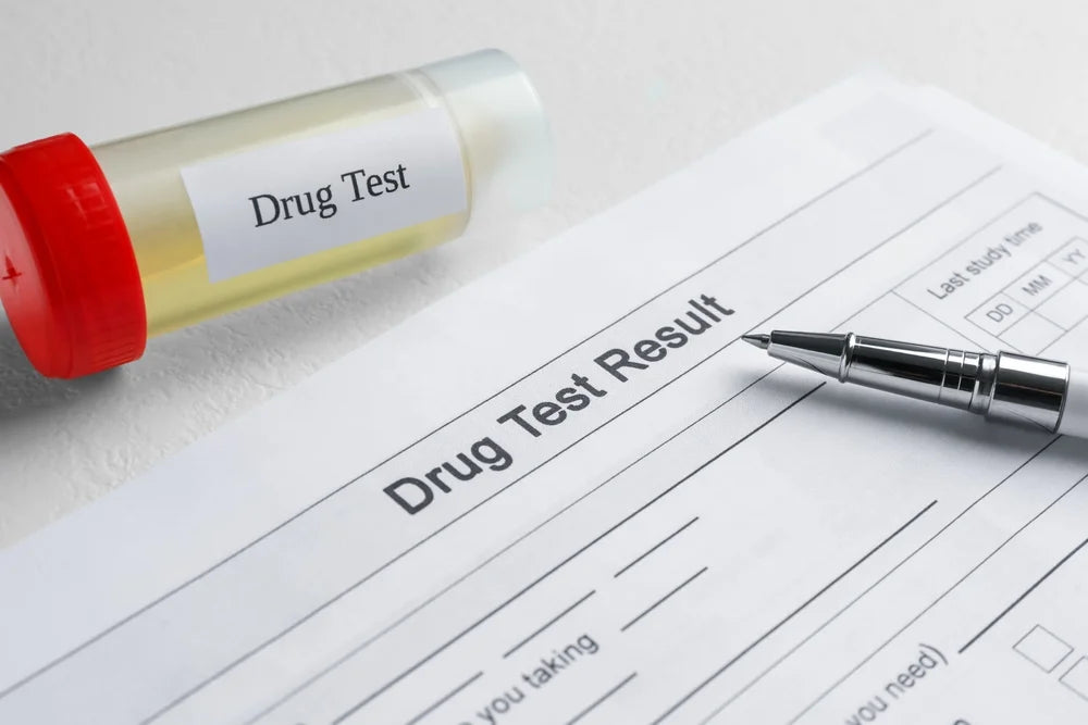Does CBD Show Up on a Drug Test?